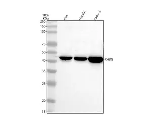 Anti-RHBG antibody used in Western Blot (WB). GTX04977