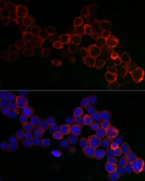 Anti-GPX1 antibody used in Immunocytochemistry/ Immunofluorescence (ICC/IF). GTX04981