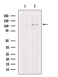 Anti-ITIH2 antibody used in Western Blot (WB). GTX04998