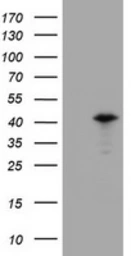 Anti-PRR11 antibody [OTI1A4] used in Western Blot (WB). GTX05022