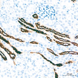 Anti-MUC1 antibody [ARC0352] used in IHC (Paraffin sections) (IHC-P). GTX05027