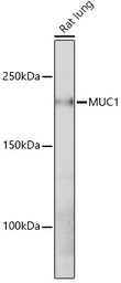 Anti-MUC1 antibody [ARC0352] used in Western Blot (WB). GTX05027