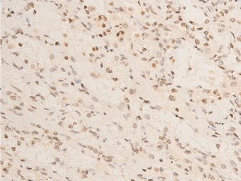 Anti-IKB alpha (phospho Ser32/Ser36) antibody used in IHC (Paraffin sections) (IHC-P). GTX05029