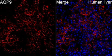 Anti-Aquaporin 9 antibody used in IHC (Paraffin sections) (IHC-P). GTX05046
