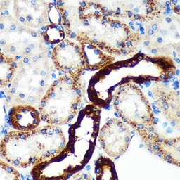 Anti-EML4 antibody used in IHC (Paraffin sections) (IHC-P). GTX05051