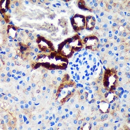 Anti-EML4 antibody used in IHC (Paraffin sections) (IHC-P). GTX05051