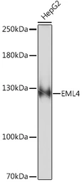 Anti-EML4 antibody used in Western Blot (WB). GTX05051