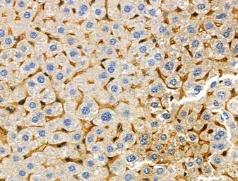 Anti-TREM1 antibody used in IHC (Paraffin sections) (IHC-P). GTX05054