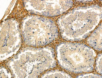 Anti-TREM1 antibody used in IHC (Paraffin sections) (IHC-P). GTX05054