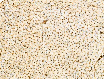 Anti-TREM1 antibody used in IHC (Paraffin sections) (IHC-P). GTX05054