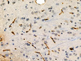 Anti-TREM1 antibody used in IHC (Paraffin sections) (IHC-P). GTX05054