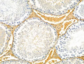 Anti-TREM1 antibody used in IHC (Paraffin sections) (IHC-P). GTX05054