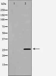 Anti-TREM1 antibody used in Western Blot (WB). GTX05054