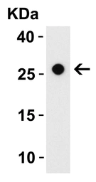 Anti-CIDE B antibody used in Western Blot (WB). GTX05061