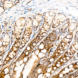 Anti-Caspase 12 antibody [ARC58203] used in IHC (Paraffin sections) (IHC-P). GTX05082