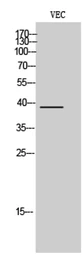 Anti-Casein Kinase 1 alpha (phospho Thr321) antibody used in Western Blot (WB). GTX05107