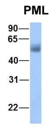 Anti-PML antibody used in Western Blot (WB). GTX05122