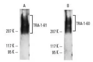 Anti-TRA-1-81 antigen antibody [TRA-1-81] used in Western Blot (WB). GTX05126