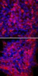 Anti-TRA-1-60 antigen antibody [TRA-1-60] used in Immunocytochemistry/ Immunofluorescence (ICC/IF). GTX05127