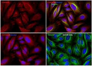 Anti-CDKN2A / p16INK4a antibody used in Immunocytochemistry/ Immunofluorescence (ICC/IF). GTX05147