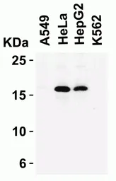 Anti-CDKN2A / p16INK4a antibody used in Western Blot (WB). GTX05147