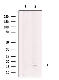 Anti-FIS1 antibody used in Western Blot (WB). GTX05149