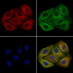 Anti-MFN1 antibody used in Immunocytochemistry/ Immunofluorescence (ICC/IF). GTX05150