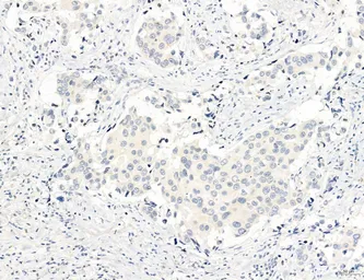 Anti-NEU4 antibody used in IHC (Paraffin sections) (IHC-P). GTX05156