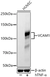Anti-VCAM1 / CD106 antibody [ARC61231] used in Western Blot (WB). GTX05160