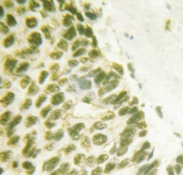 Anti-FANCD2 (phospho Ser222) antibody used in IHC (Paraffin sections) (IHC-P). GTX05195