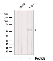Anti-POMGNT1 antibody used in Western Blot (WB). GTX05196