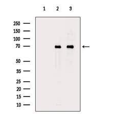 Anti-DDX5 antibody used in Western Blot (WB). GTX05200