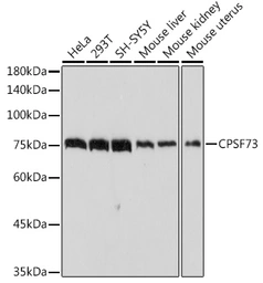 Anti-CPSF73 antibody [ARC2567] used in Western Blot (WB). GTX05201