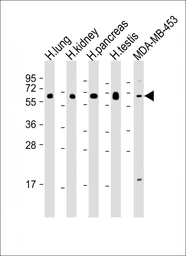 Anti-HHLA2 antibody used in Western Blot (WB). GTX05203