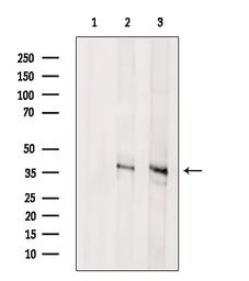 Anti-Asporin antibody used in Western Blot (WB). GTX05211