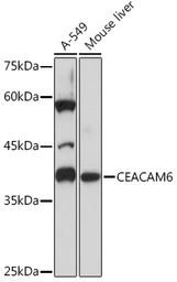 Anti-CEACAM6 antibody [ARC2110] used in Western Blot (WB). GTX05214