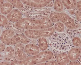 Anti-NOX4 antibody [E-14] used in IHC (Paraffin sections) (IHC-P). GTX05217