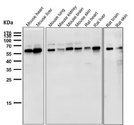 Anti-NOX4 antibody [E-14] used in Western Blot (WB). GTX05217