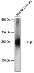 Anti-C1qC antibody used in Western Blot (WB). GTX05218