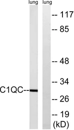 Anti-C1qC antibody used in Western Blot (WB). GTX05219