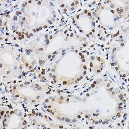 Anti-PER2 antibody used in IHC (Paraffin sections) (IHC-P). GTX05220