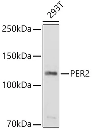 Anti-PER2 antibody used in Western Blot (WB). GTX05220