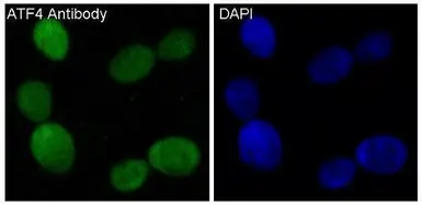 Anti-ATF4 antibody [HCI-1] used in Immunocytochemistry/ Immunofluorescence (ICC/IF). GTX05222