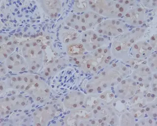 Anti-ATF4 antibody [HCI-1] used in IHC (Paraffin sections) (IHC-P). GTX05222