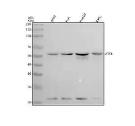 Anti-ATF4 antibody [HCI-1] used in Western Blot (WB). GTX05222