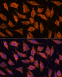 Anti-KIF13A antibody used in Immunocytochemistry/ Immunofluorescence (ICC/IF). GTX05224