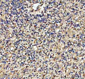 Anti-ADAM10 antibody [AAIC-1] used in IHC (Paraffin sections) (IHC-P). GTX05227