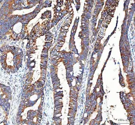 Anti-Integrin alpha 3 antibody used in IHC (Paraffin sections) (IHC-P). GTX05230