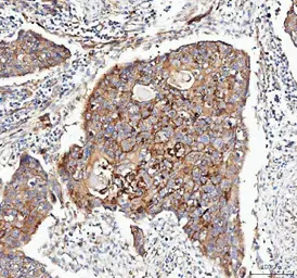 Anti-Integrin alpha 3 antibody used in IHC (Paraffin sections) (IHC-P). GTX05230