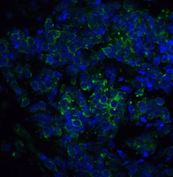 Anti-ST2 antibody used in IHC (Paraffin sections) (IHC-P). GTX05232